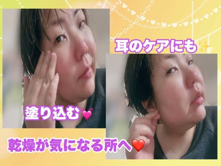 モイスチュア バーム/カルテHD/フェイスバームを使ったクチコミ(3枚目)