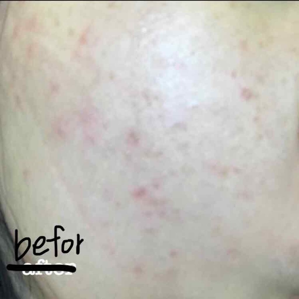 DHC ビタミンBミックス/DHC/美容サプリメントを使ったクチコミ（2枚目）