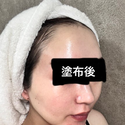 リードルショット100/VT/美容液を使ったクチコミ(3枚目)