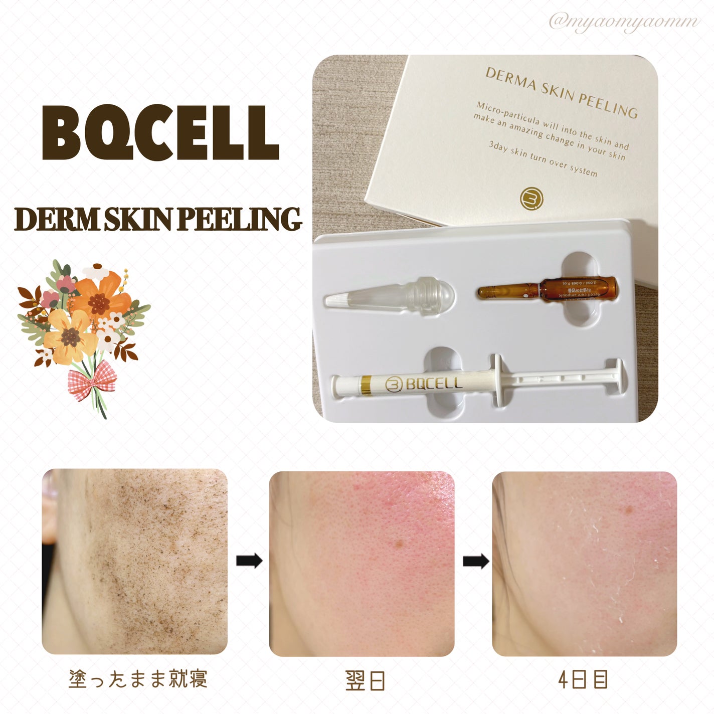 ダーマスキンピーリング/BQCELL/その他キットセットを使ったクチコミ(3枚目)