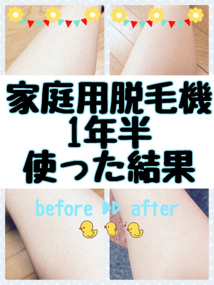ブラウンシルクエキスパート (光美容器)/ブラウン/家庭用脱毛器を使ったクチコミ(1枚目)
