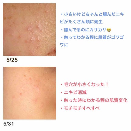 DHC ビタミンCハードカプセル/DHC/美容サプリメントを使ったクチコミ(4枚目)