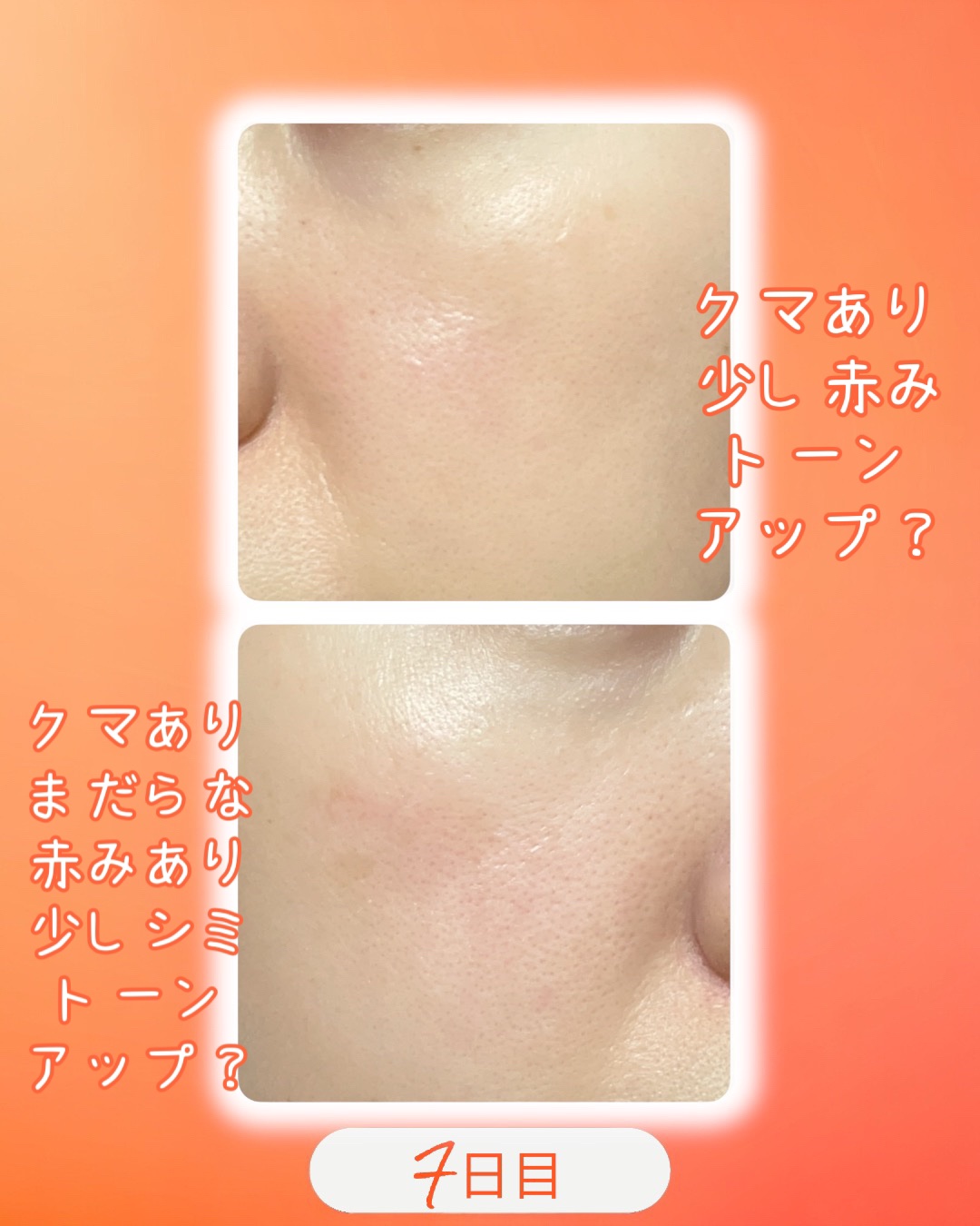 TXトーニングデイリーマスク/VT/その他スキンケアを使ったクチコミ（3枚目）