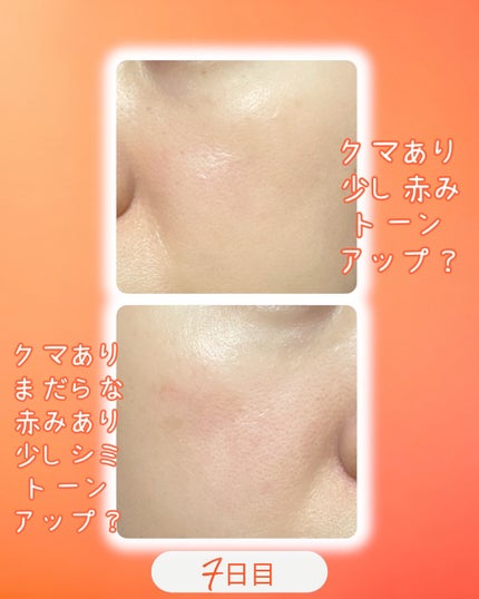 TXトーニングエッセンス2000/VT/美容液を使ったクチコミ(3枚目)