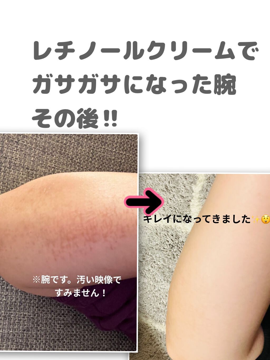 レチノールA 1% アドバンスドリバイタリゼーションクリーム/Life-flo/フェイスクリームを使ったクチコミ（1枚目）