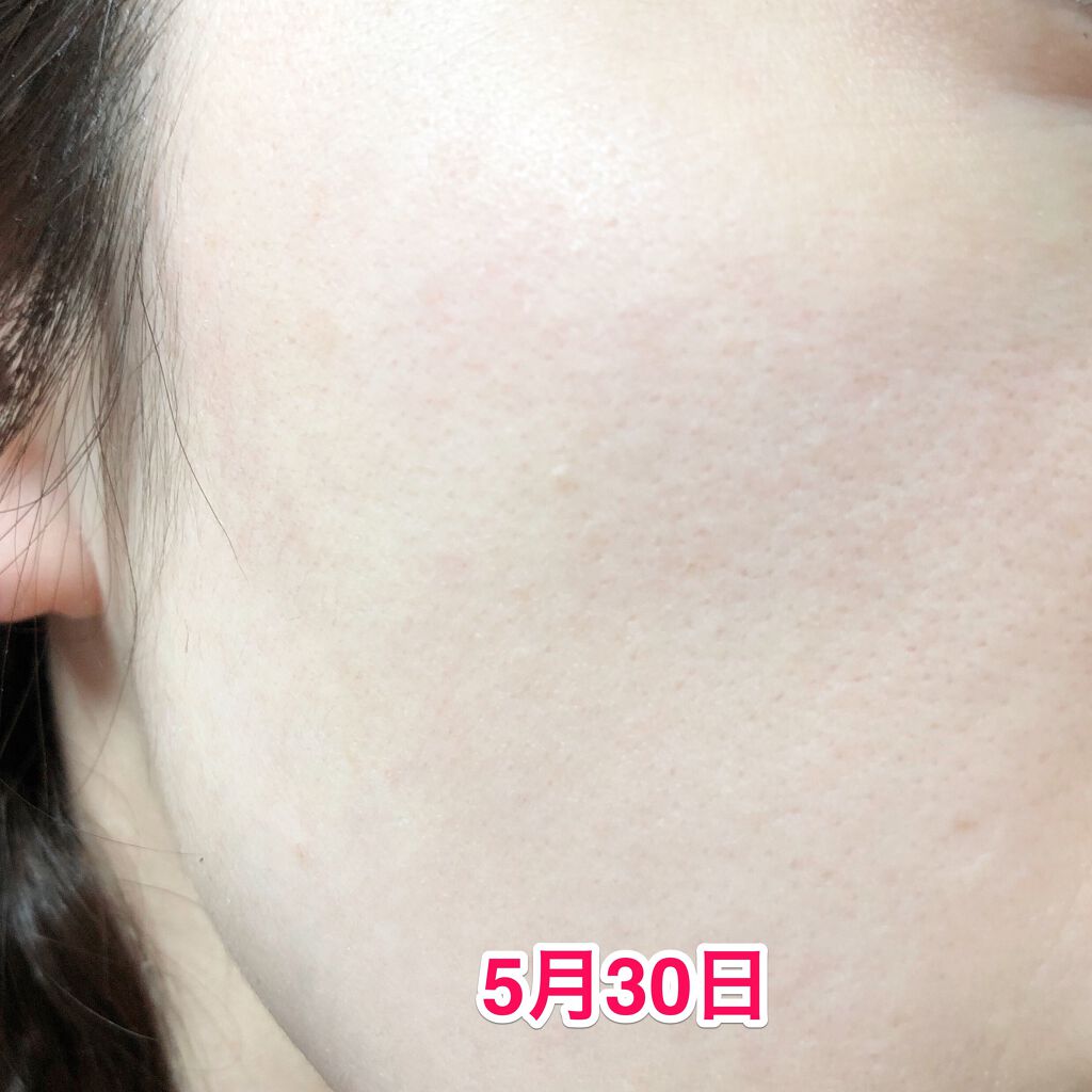 レディブラン 薬用美白ピールホワイト/シーヴァ/洗い流すパック・マスクを使ったクチコミ(4枚目)