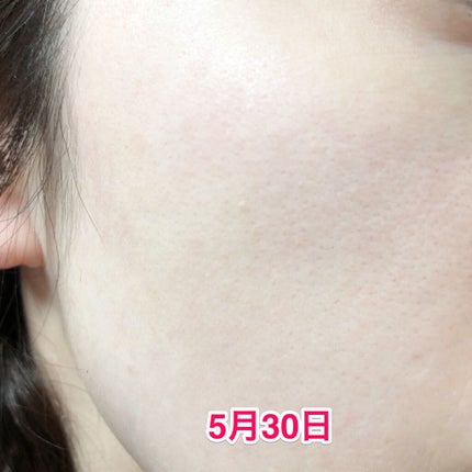 レディブラン 薬用美白ピールホワイト/シーヴァ/洗い流すパック・マスクを使ったクチコミ(4枚目)