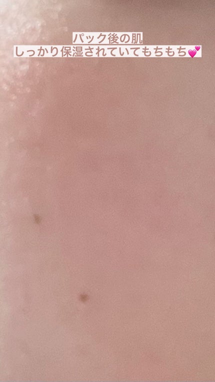 毛穴小町 テカリ源治 マスク/クリアターン/シートマスク・パックを使ったクチコミ(6枚目)