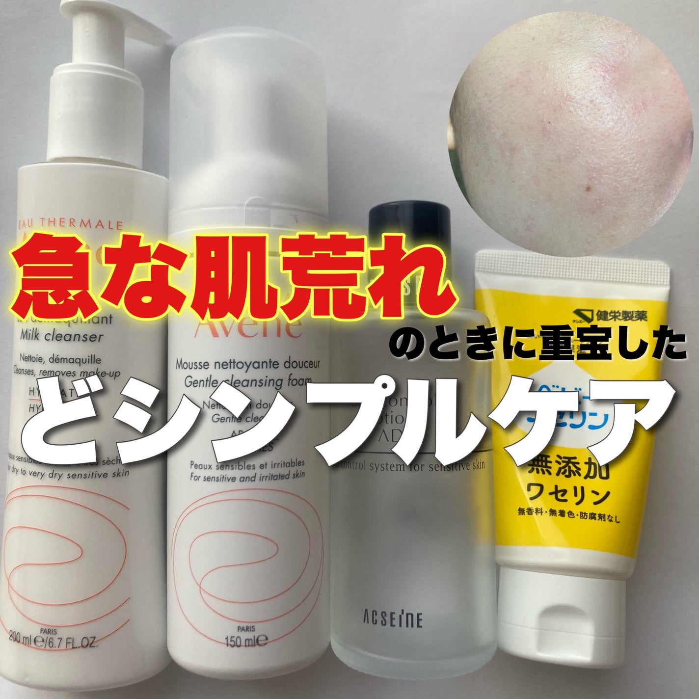 AD コントロール ローション/ACSEINE/化粧水を使ったクチコミ(1枚目)