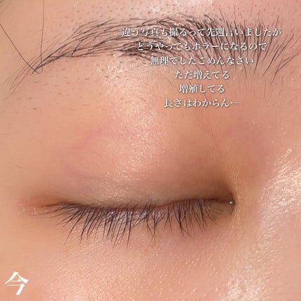 FEG  Eyelash  Enhancer/FEG/まつげ美容液を使ったクチコミ(3枚目)