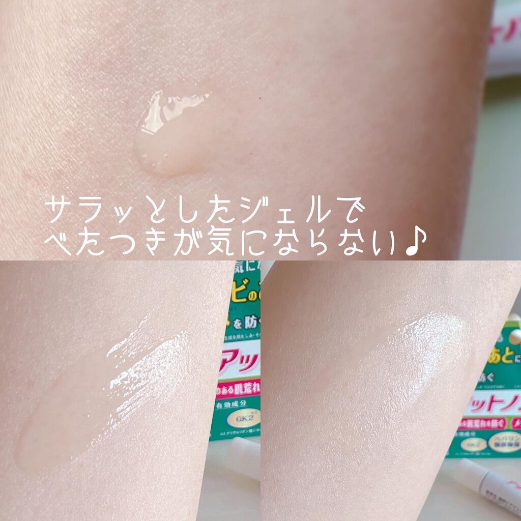 ニキビあとケアジェル/アットノン/その他スキンケアを使ったクチコミ(3枚目)