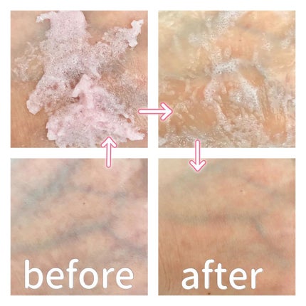 Q+Me スウィート ボム タラソ スクラブ/AGARISM/バスト・ヒップケアを使ったクチコミ(4枚目)