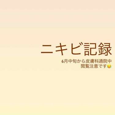 ⚠️閲覧注意⚠️

高校生の時から二十代の今も、現在進行形で悩まされているのが『ニキビ』😭

学生時代、皮膚科に2年ほど通院
↓
効果がないため、いろいろなスキンケアを試すこと数年
↓
やっぱり効果がな