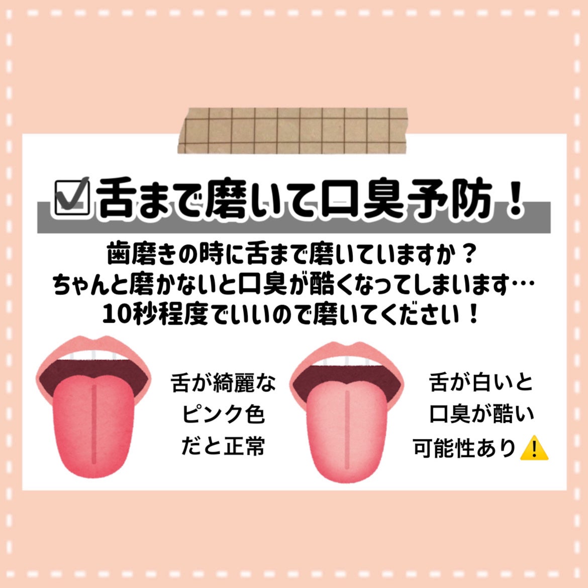 UHAグミサプリ ビタミンC/UHA味覚糖/食品を使ったクチコミ(4枚目)