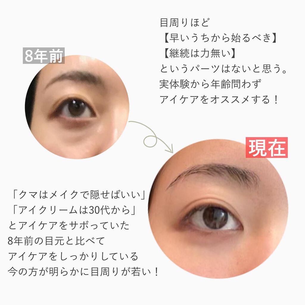 アドバンス ナイト リペア アイ コンセントレイト/ESTEE LAUDER/アイケア・アイクリームを使ったクチコミ（2枚目）