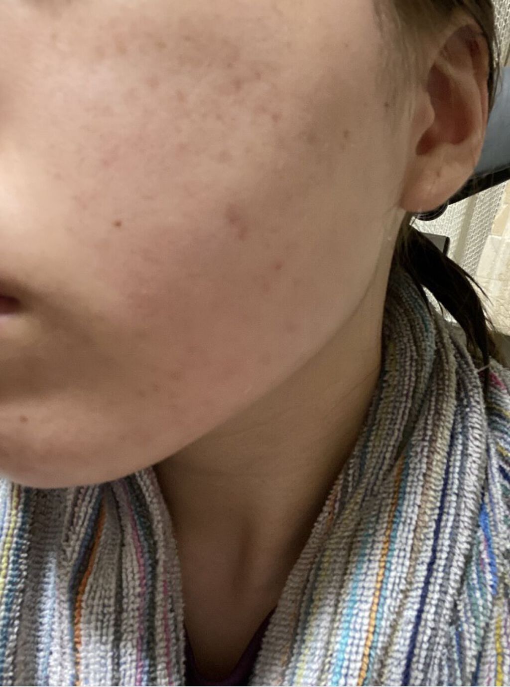 ビジャ シカバーム EX/innisfree/フェイスバームを使ったクチコミ（3枚目）