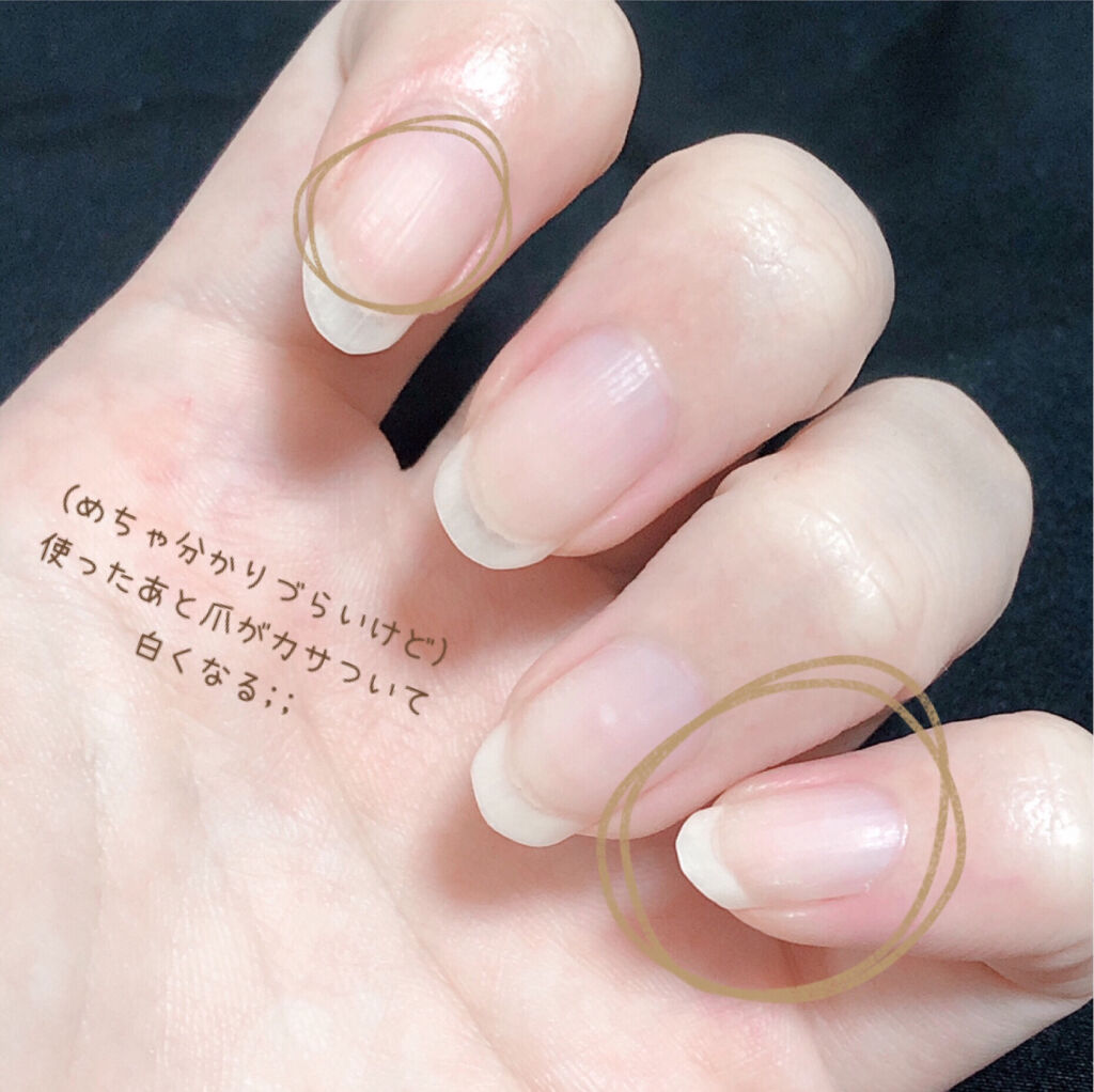 除光液/ちふれ/除光液を使ったクチコミ（3枚目）