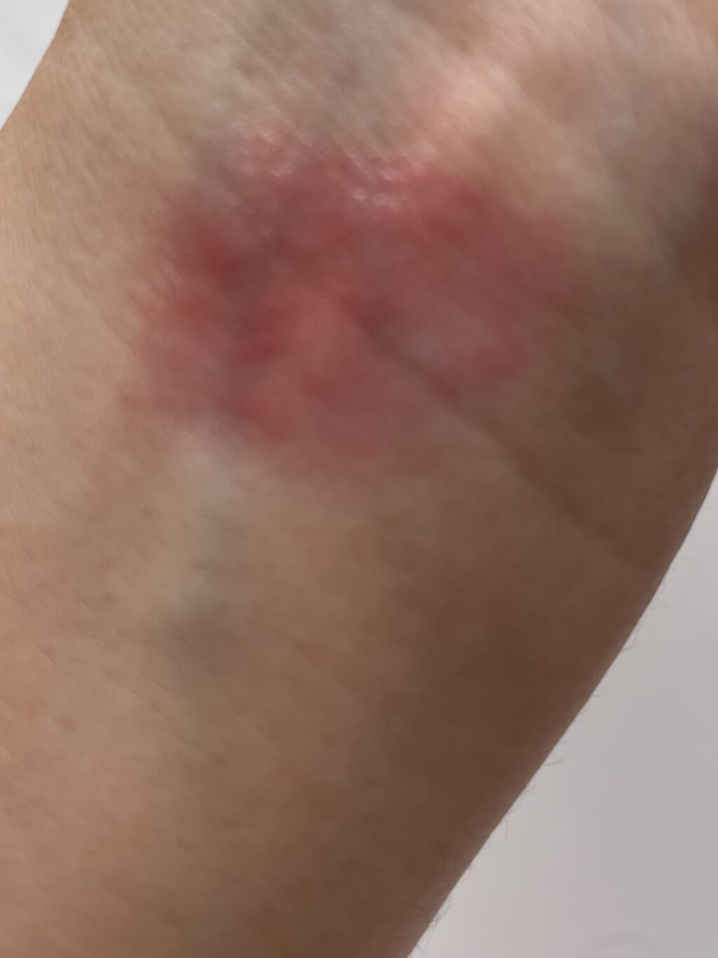 アフターグロー リップバーム 3420/NARS/リップバームを使ったクチコミ（2枚目）