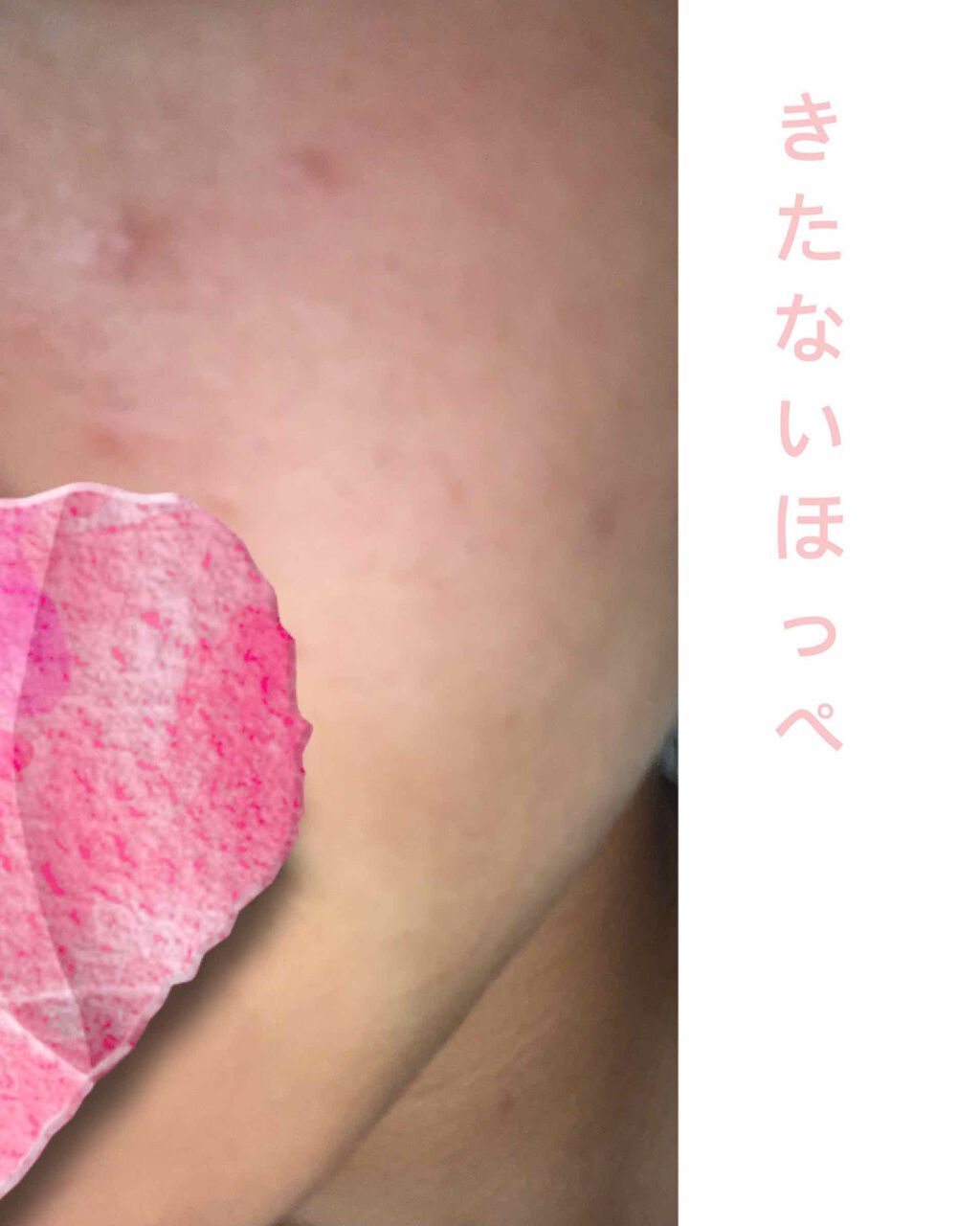 DHC ビタミンBミックス/DHC/美容サプリメントを使ったクチコミ(2枚目)