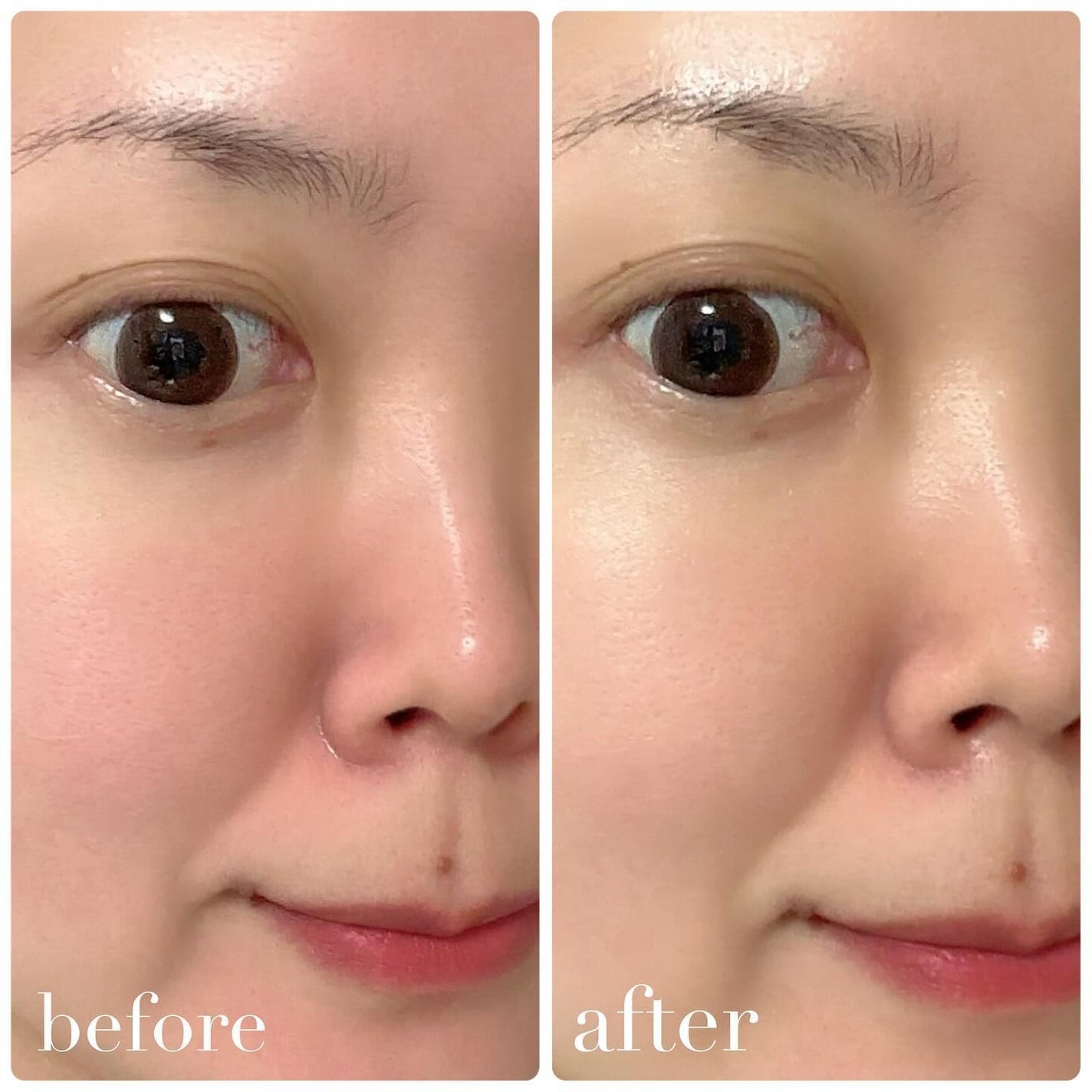 ナインセラム/Dr.Twenty Project/美容液を使ったクチコミ(3枚目)