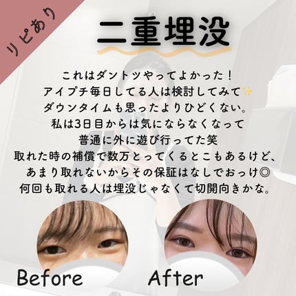 ðððð€ËË on LIPS ããªãããã»ãªããªãçŸå®¹å»çâ»éžïŒã³ããçŠãæããŠçŸå®¹å»çã«ã..ãïŒ5æç®ïŒ