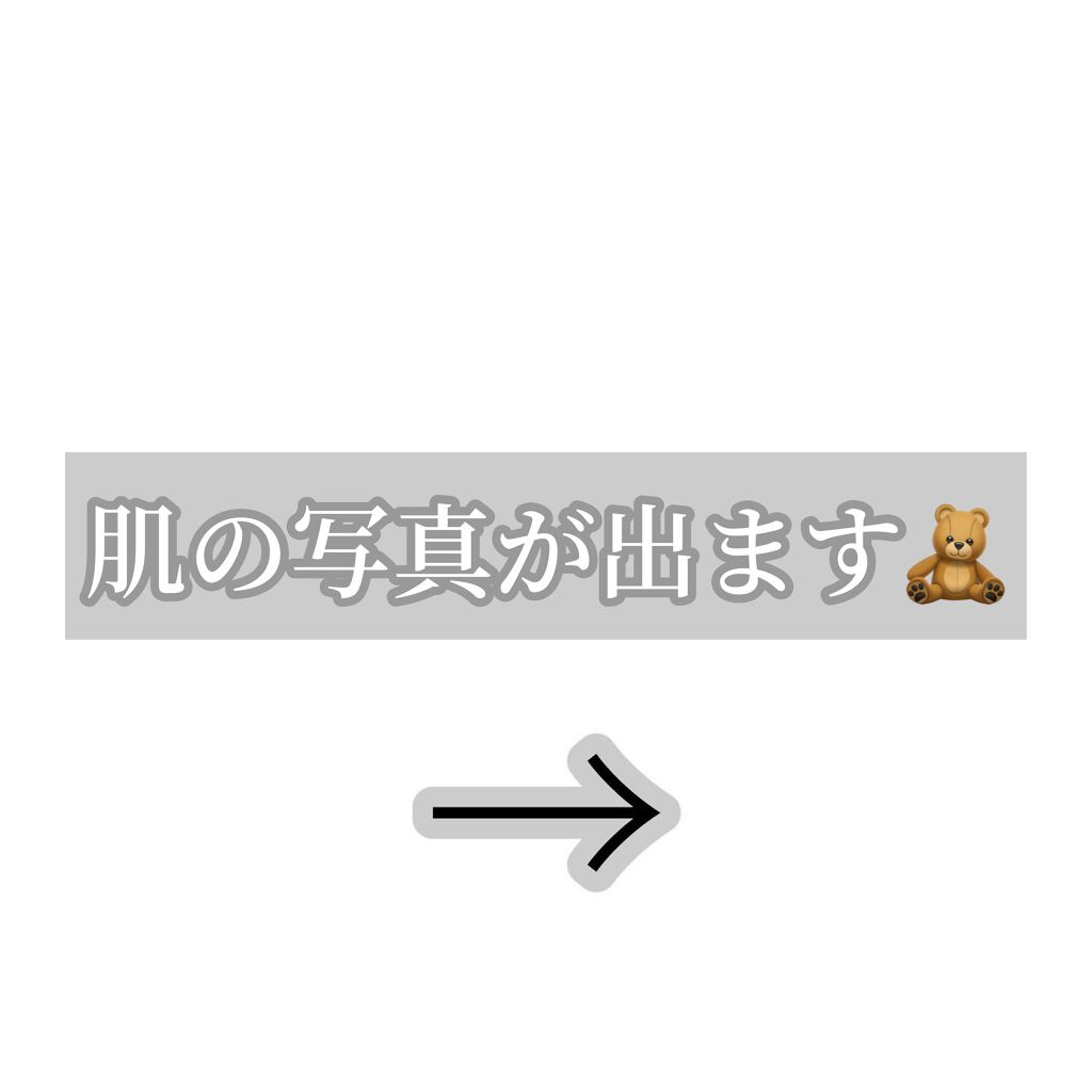 極薄透明パッチ nikipa!/金冠堂/にきびパッチを使ったクチコミ(8枚目)