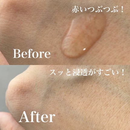 ベネフィーク セラム/BENEFIQUE/美容液を使ったクチコミ(3枚目)