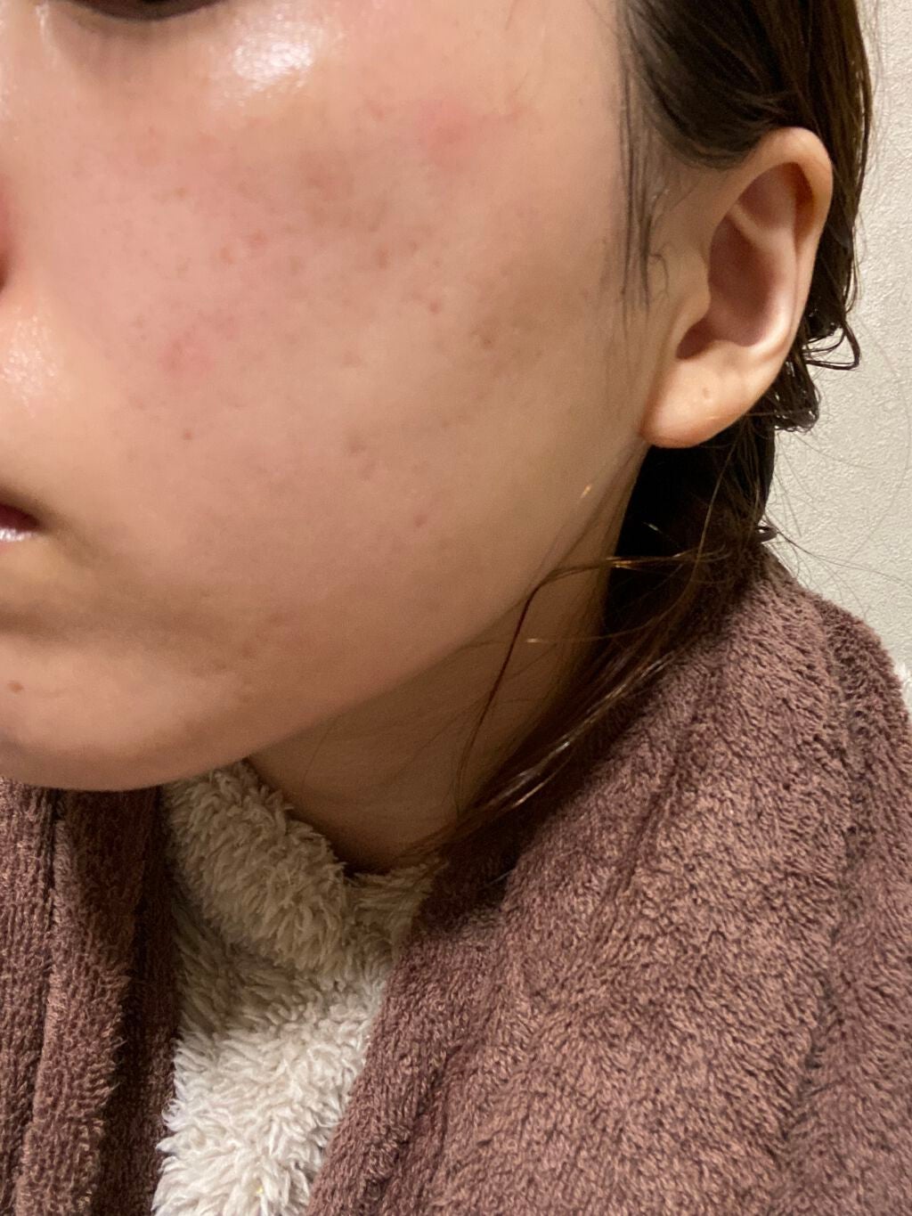 ティーツリーケアソリューション アンプルマスクJEX/MEDIHEAL/シートマスク・パックを使ったクチコミ(4枚目)