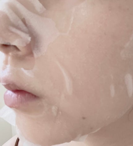 ダーマレーザー スーパー VC100 ホワイトマスク/クオリティファースト/シートマスク・パックを使ったクチコミ(2枚目)