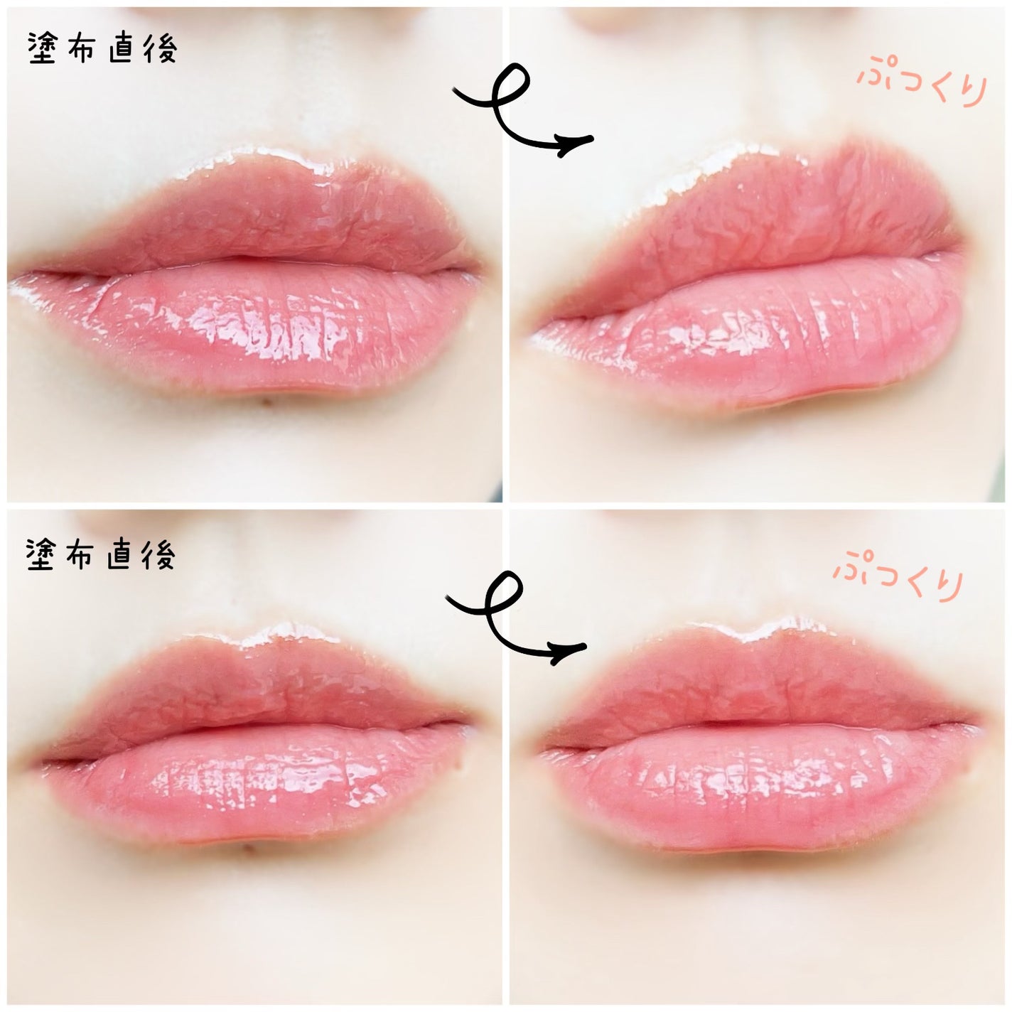 キューミ―ボムショットリッププランパー/AGARISM/リッププランパーを使ったクチコミ(6枚目)