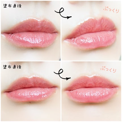 キューミ―ボムショットリッププランパー/AGARISM/リッププランパーを使ったクチコミ(6枚目)