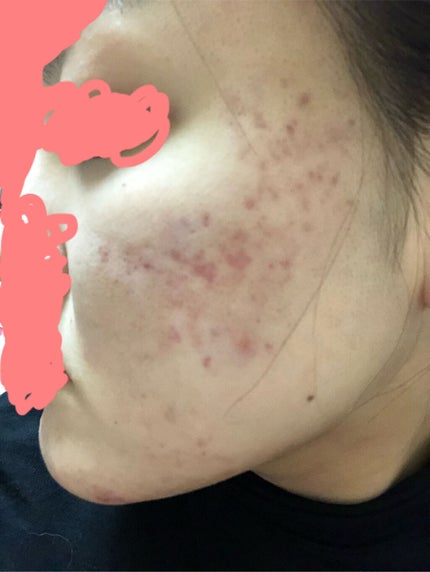 を使ったクチコミ(1枚目)