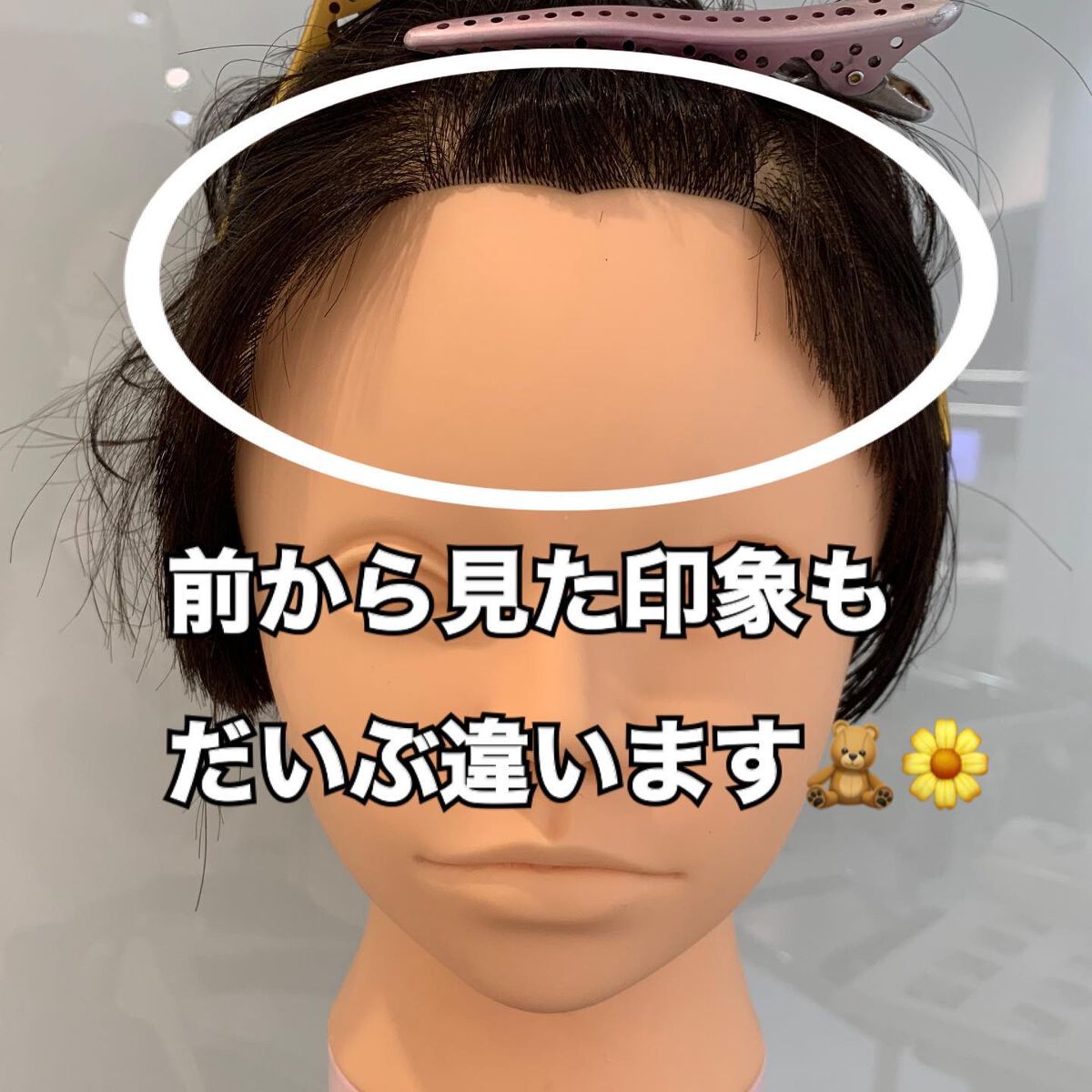 ♡a y a n e♡ 美容師✂️ 【フォロバ100】 on LIPS 「..生え際のお悩み解決☺️👌🏻✨.#チャンモリパーマ..➼前髪..」(3枚目)