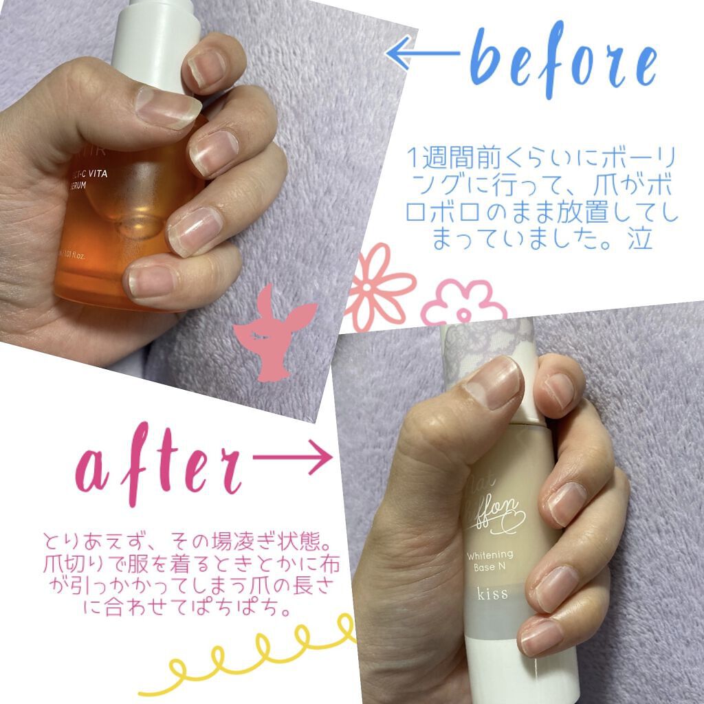 パーフェクトCビタセラム/TIRTIR(ティルティル)/美容液を使ったクチコミ（1枚目）