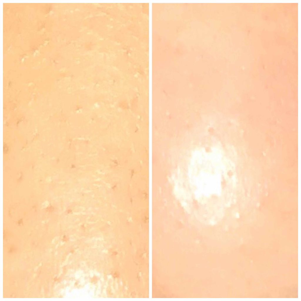 シラクル ビューティシート/Ciracle/トナーパッドを使ったクチコミ(3枚目)