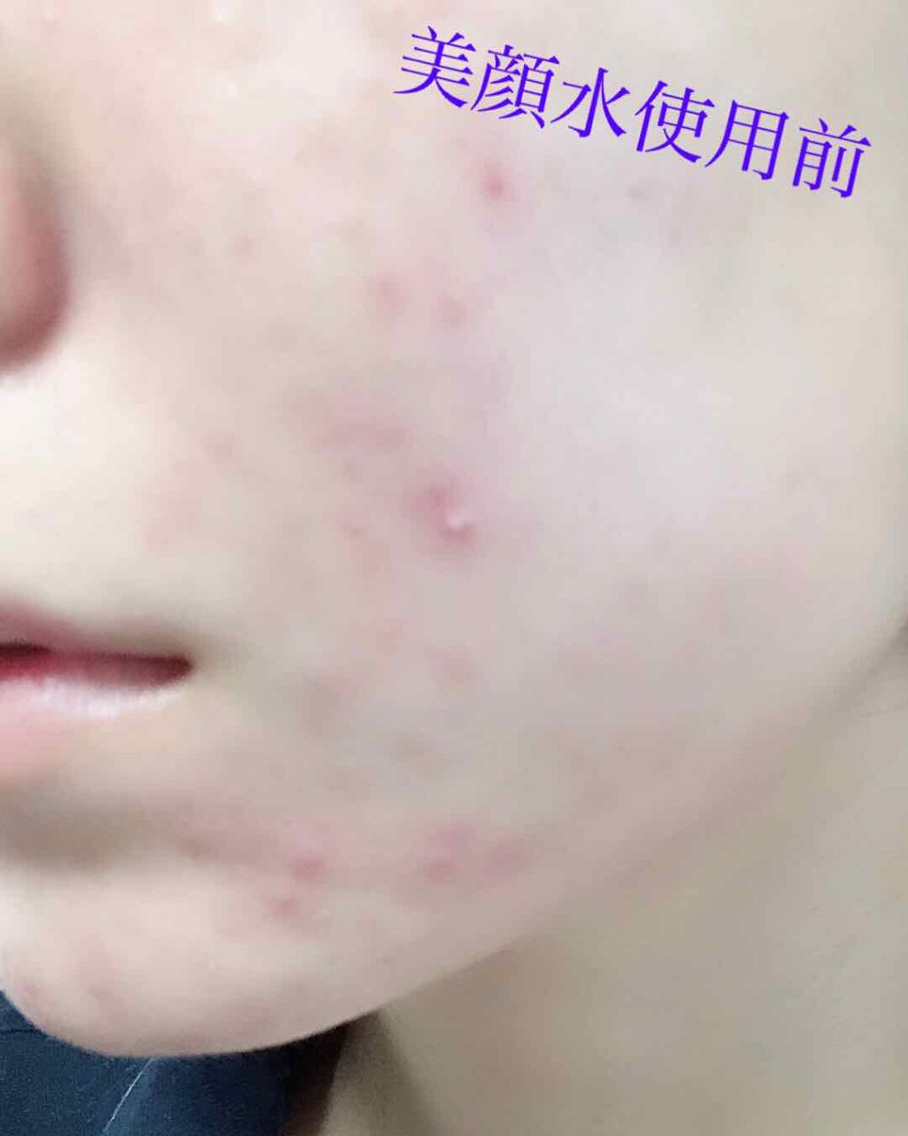 明色美顔水 薬用化粧水/美顔/化粧水を使ったクチコミ（2枚目）