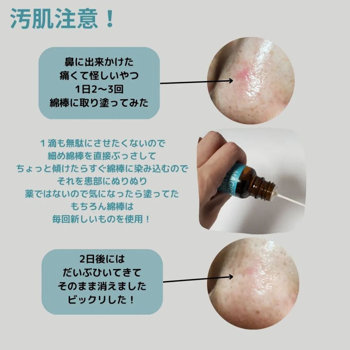 マジックティーツリーオイル/ブラン/フェイスオイルを使ったクチコミ(3枚目)