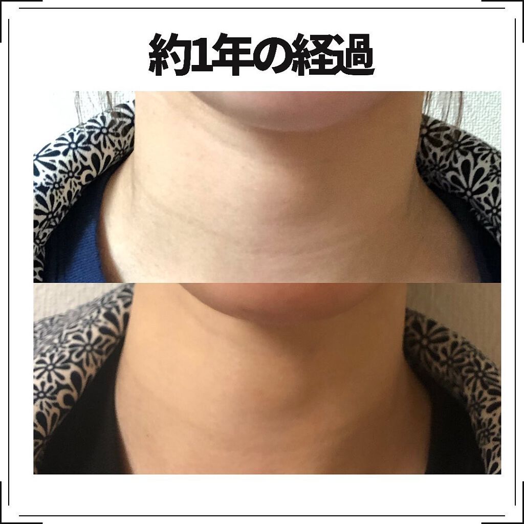 リバイタライジングビタミンAコンプレックス/Sympli Beautiful/美容液を使ったクチコミ（2枚目）