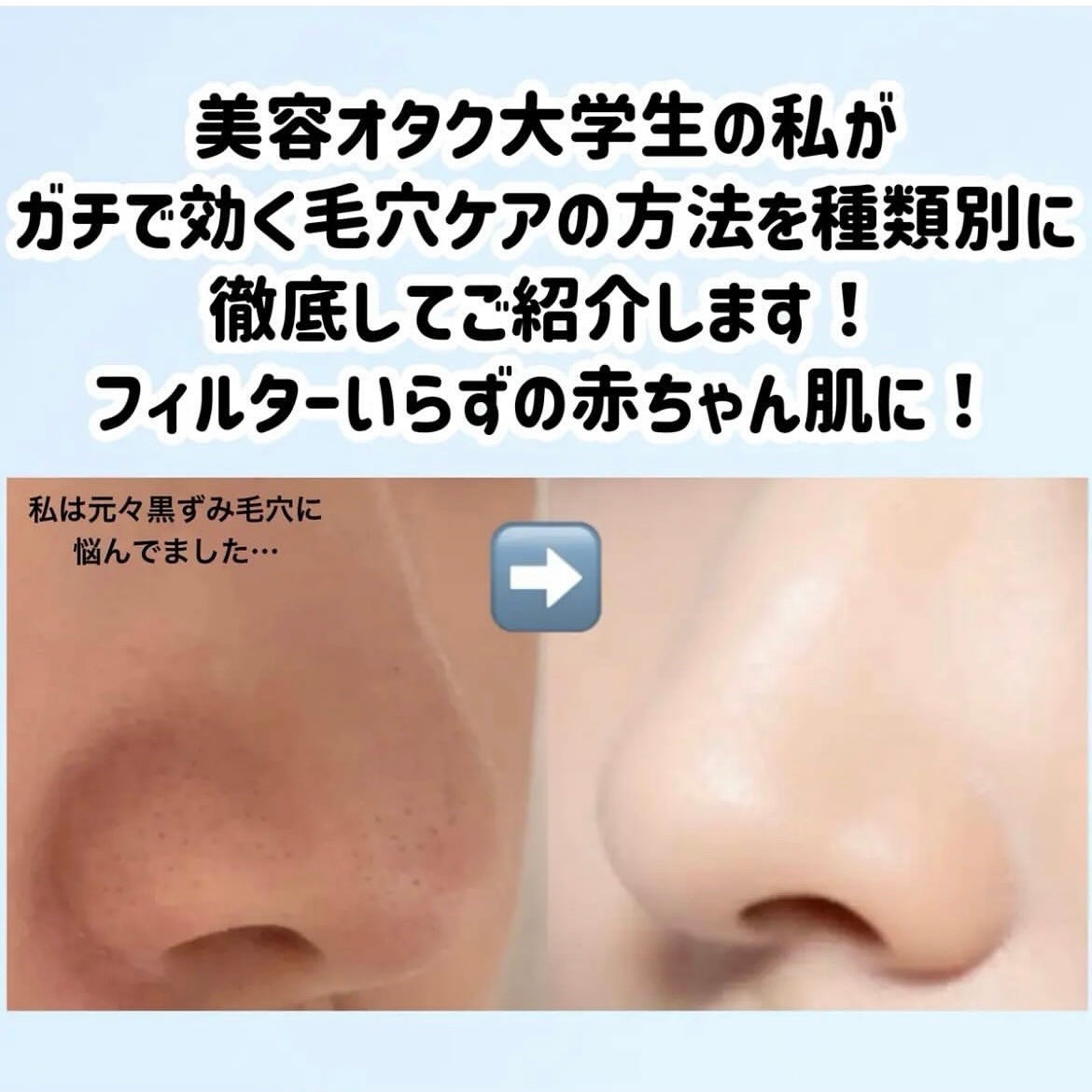 ソフティモ スピーディ クレンジングオイル/ソフティモ/オイルクレンジングを使ったクチコミ(3枚目)