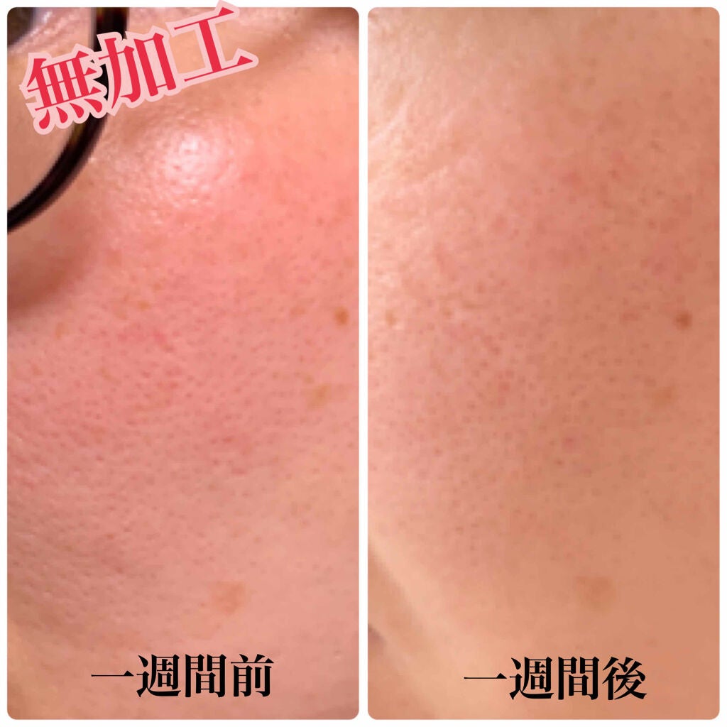 SURISURI /R&/化粧水を使ったクチコミ(3枚目)