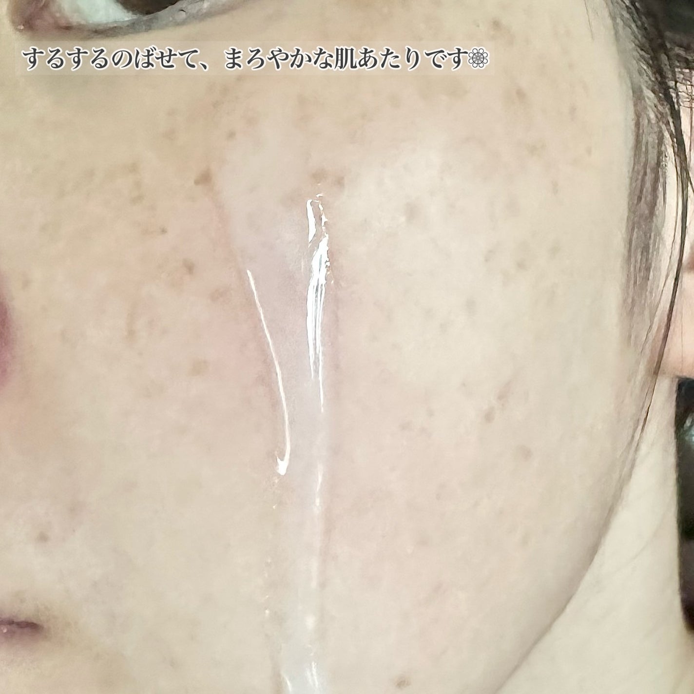 美白ウォータリースキンローション/世田谷コスメ/化粧水を使ったクチコミ(3枚目)