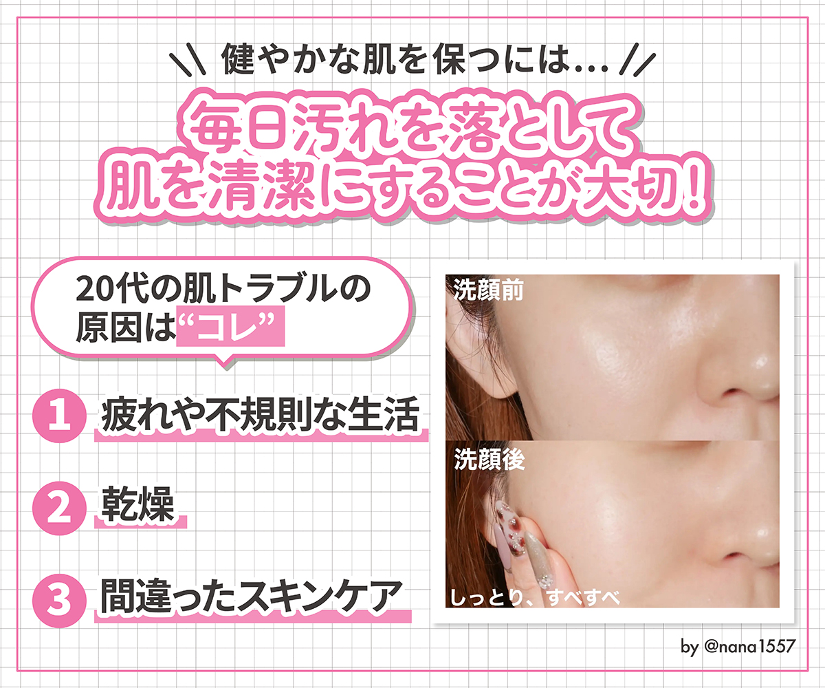 健やかな肌を保つには毎日汚れを落として肌を清潔にすることが大切！ 20代の肌トラブルの原因は疲れや不規則な生活・乾燥・間違ったスキンケアです。