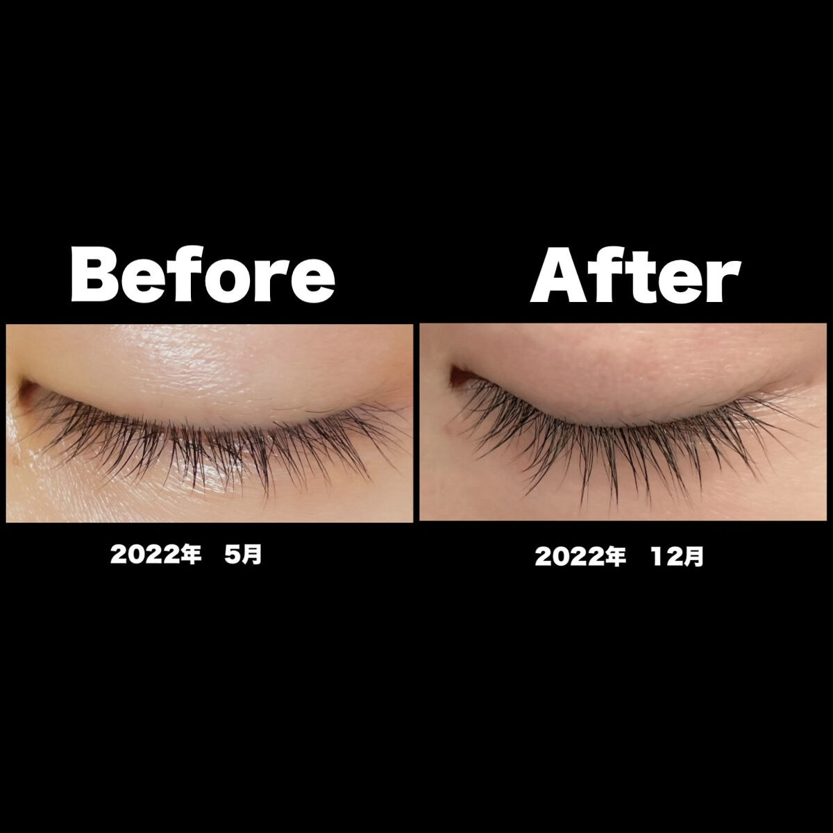 アーニストアイラッシュセラム/BENTON/まつげ美容液を使ったクチコミ（2枚目）