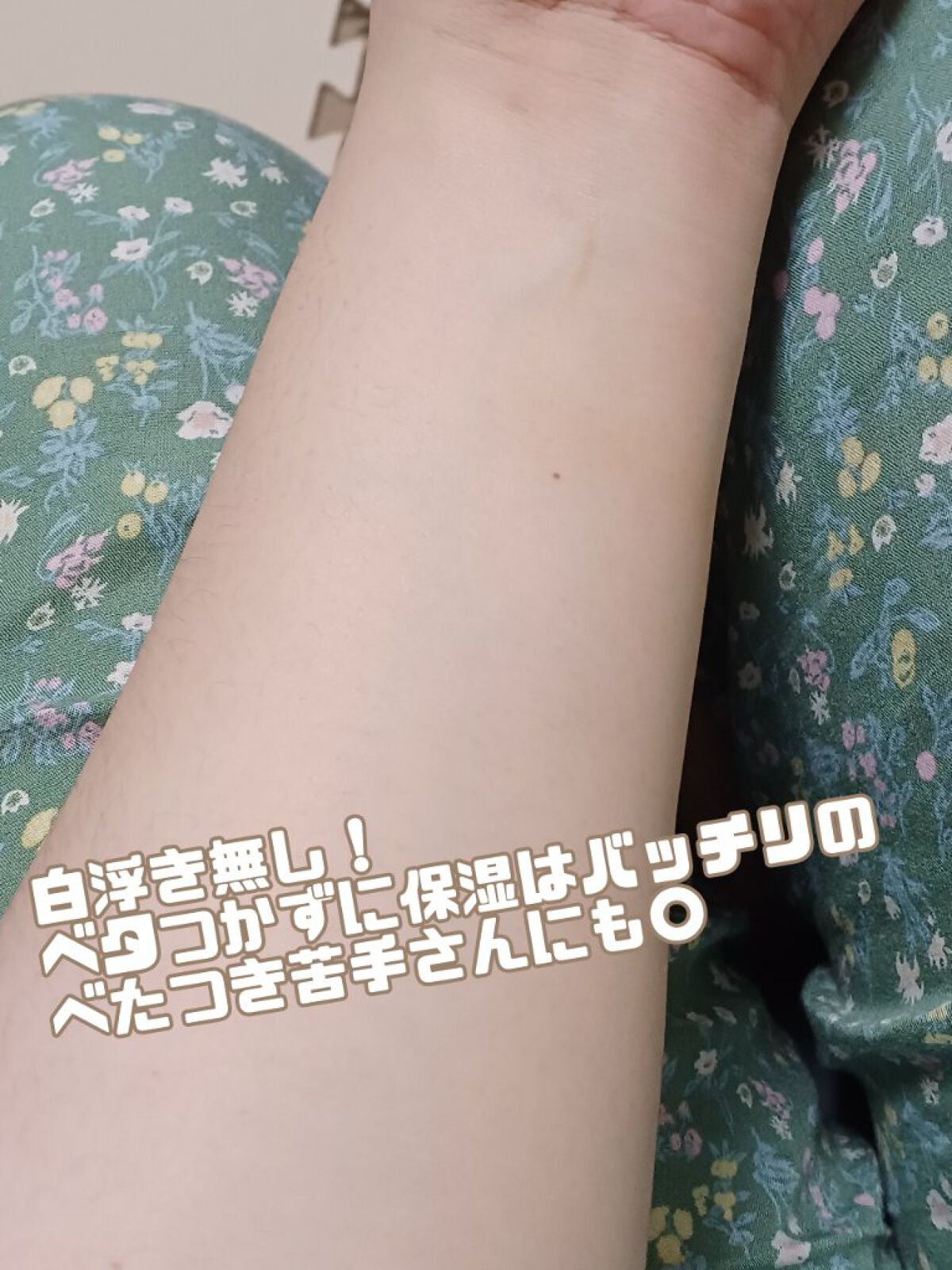 ウルトラモイスチャーボディクリーム/Derma:B/ボディクリームを使ったクチコミ（3枚目）