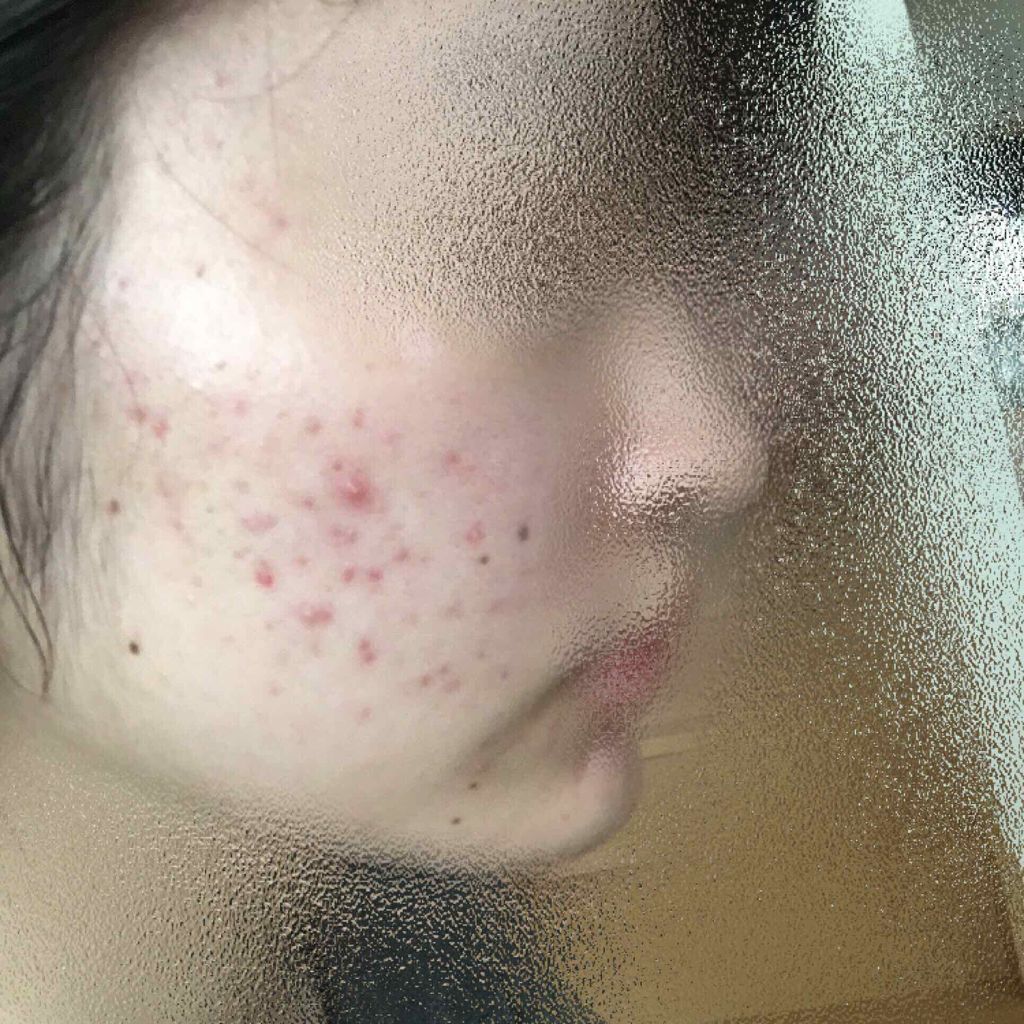 ホワイトアップ ローション(III)/アクアレーベル/化粧水を使ったクチコミ（3枚目）