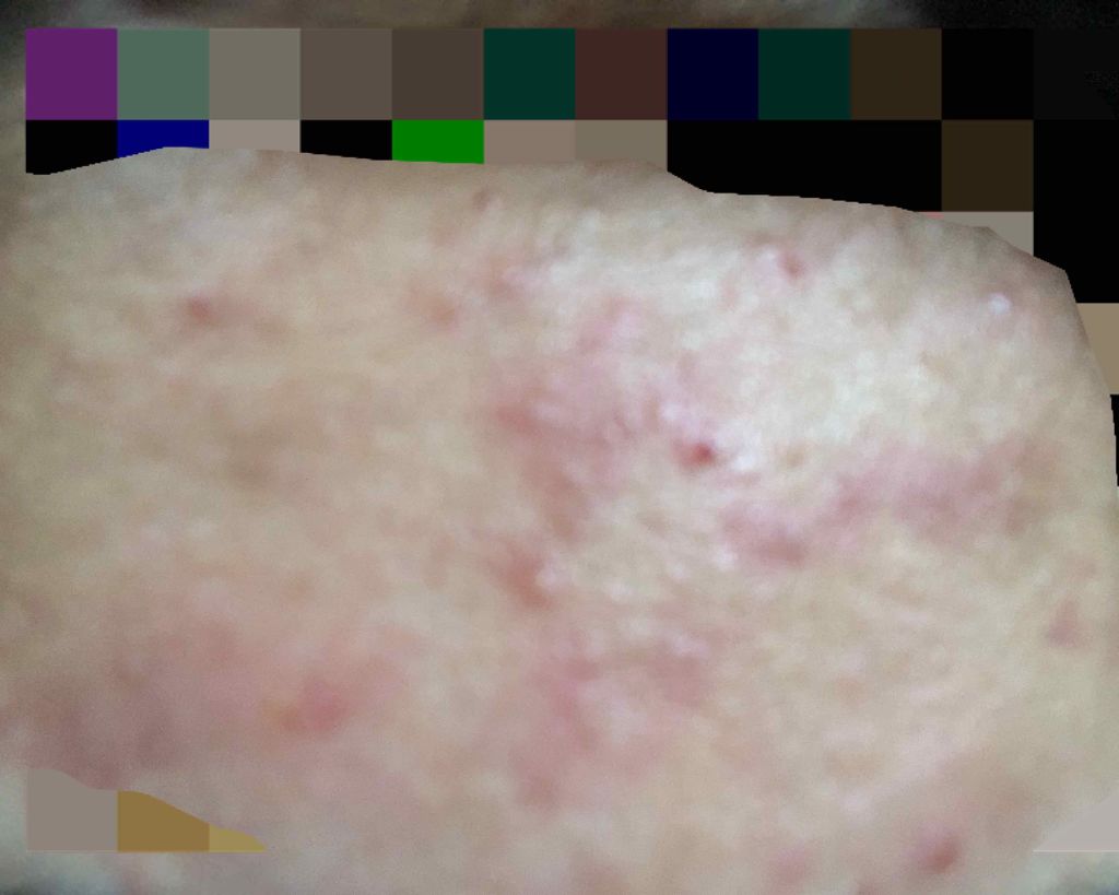 ハトムギ化粧水(ナチュリエ スキンコンディショナー R )/ナチュリエ/化粧水を使ったクチコミ(3枚目)