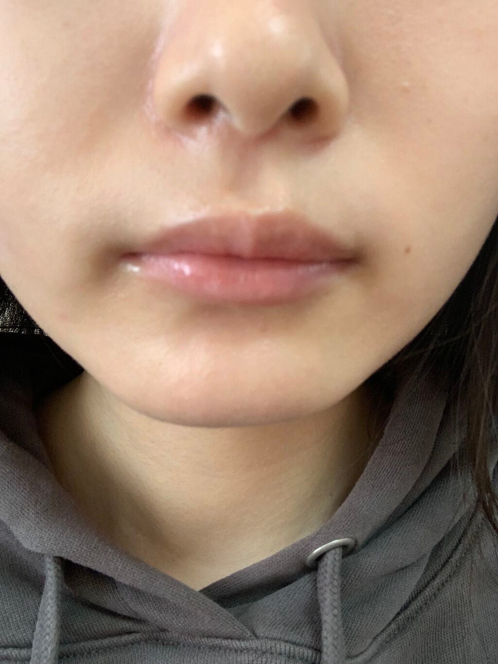 光美容器KE-NON(ケノン)/エムテック/家庭用脱毛器を使ったクチコミ(3枚目)