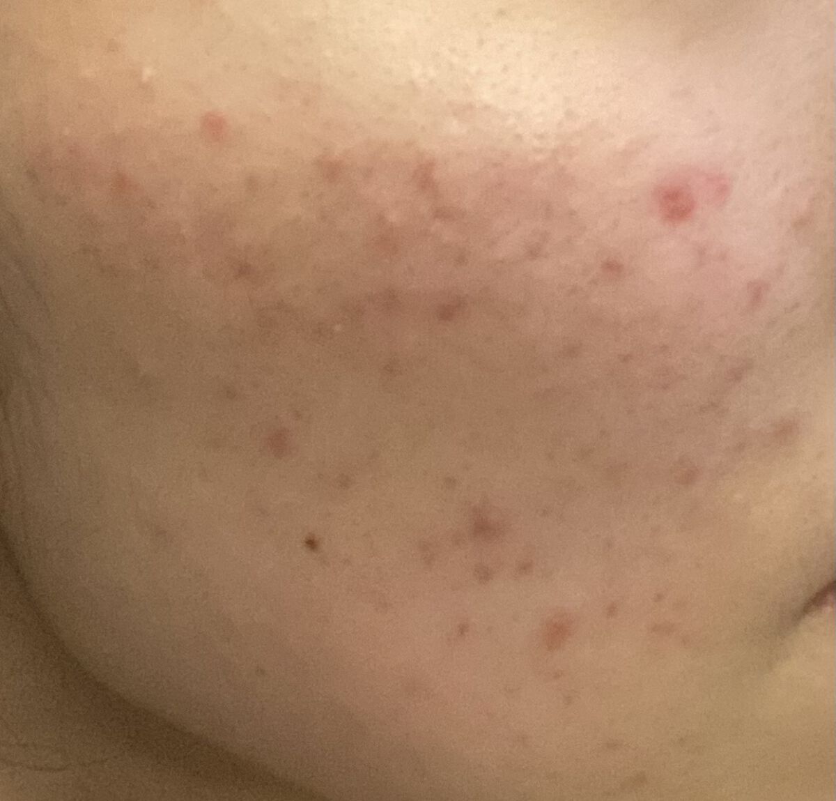 BCローション/DAISO/美容液を使ったクチコミ（2枚目）