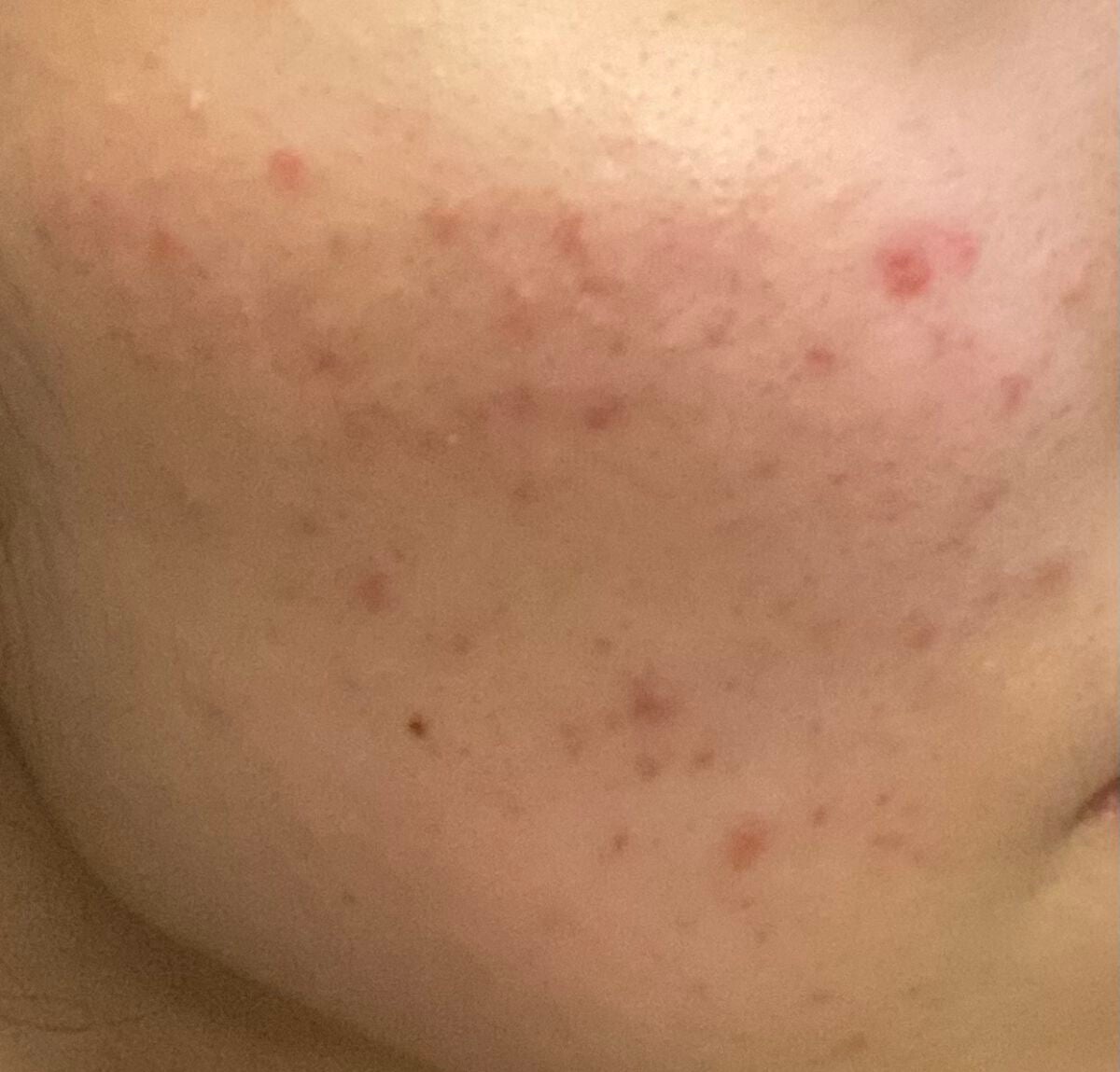 DHC ビタミンCハードカプセル/DHC/美容サプリメントを使ったクチコミ(2枚目)