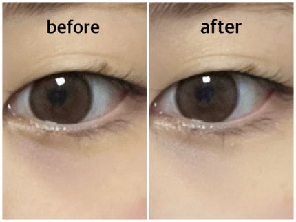 アイレノール クマクリーム/IRENOL/アイケア・アイクリームを使ったクチコミ(3枚目)